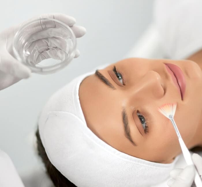 Chemical Face peel procedure