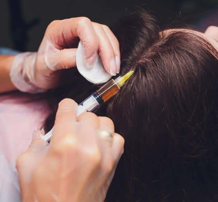 Mesotherapy hair regrowth treatment