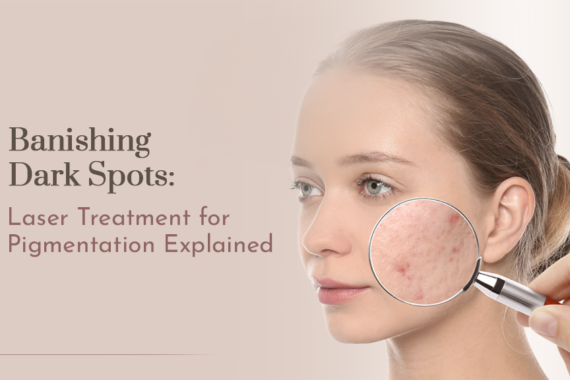 Banishing Dark Spots