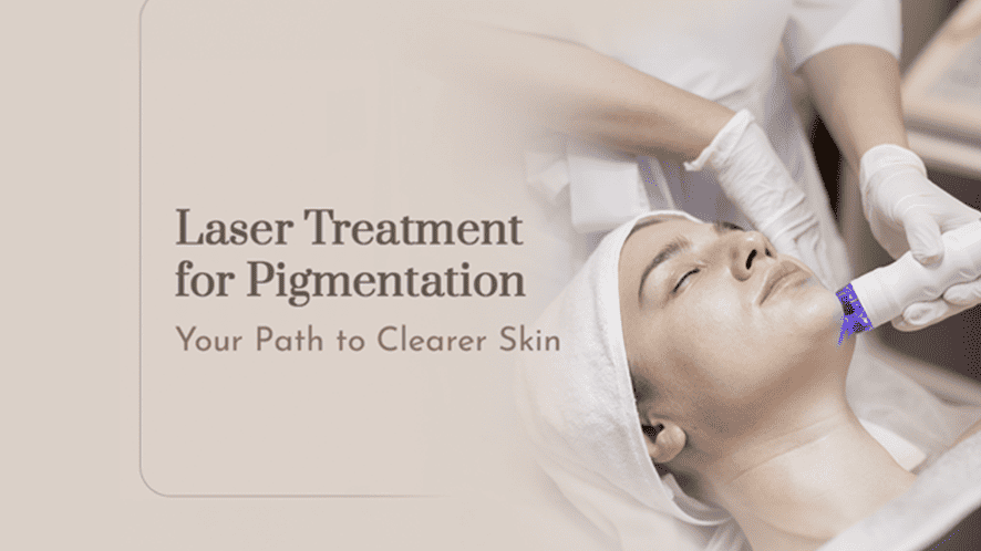 Banishing Dark Spots : Laser Treatment for Pigmentation Explained