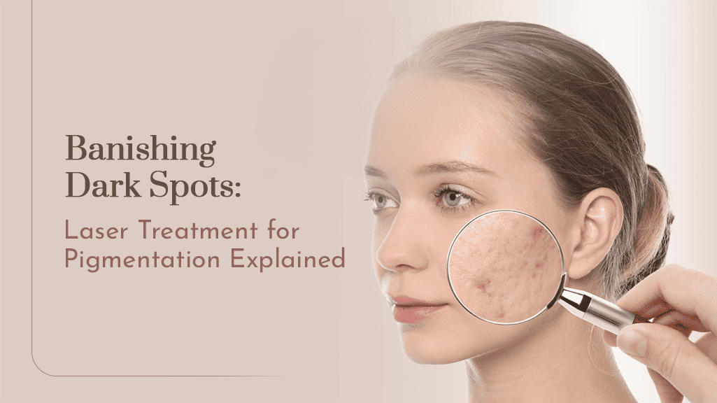 Laser Treatment for Pigmentation for banishing dark spots