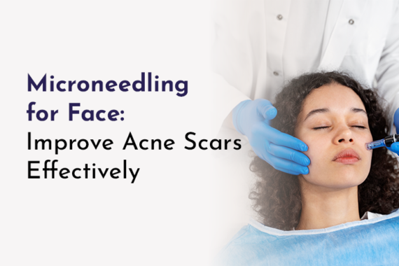 microneedling for face at avah