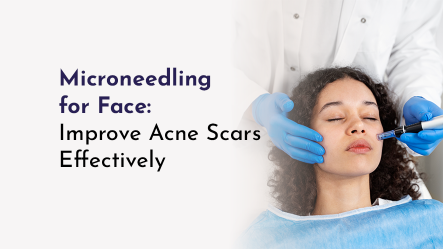 microneedling for face at avah