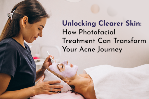 photofacial treatment at Avah