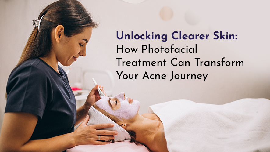 photofacial treatment at Avah