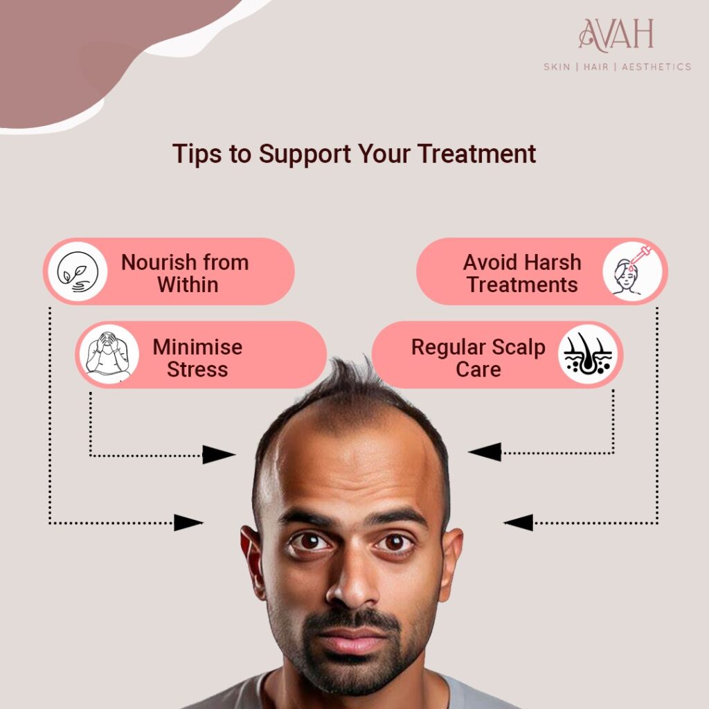 Preventing Hair Loss: Tips to Support Your Treatment